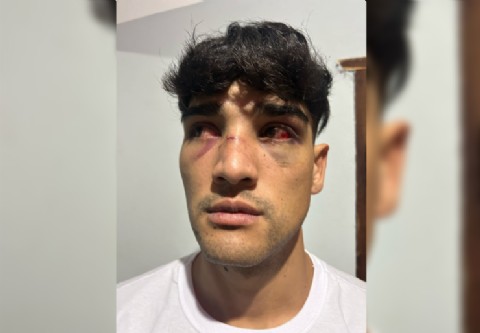 VIDEO | Capital: brutal ataque de seis policías a un joven que no había hecho nada en la salida de un boliche