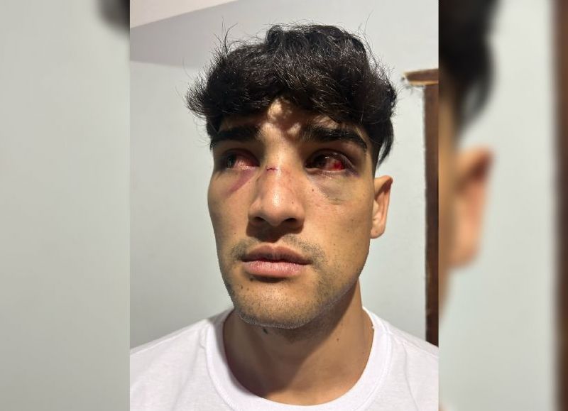 VIDEO | Capital: brutal ataque de seis policías a un joven que no había hecho nada en la salida de un boliche